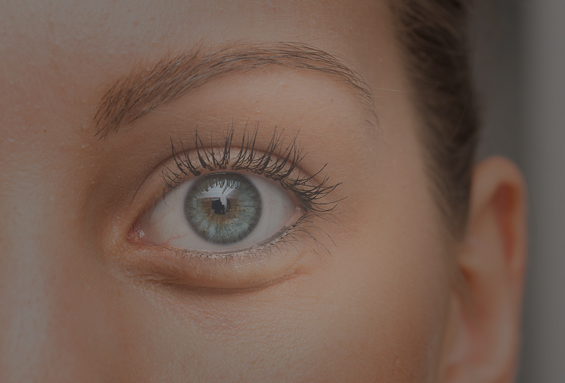 What are the causes of under eye bags - Clinics International