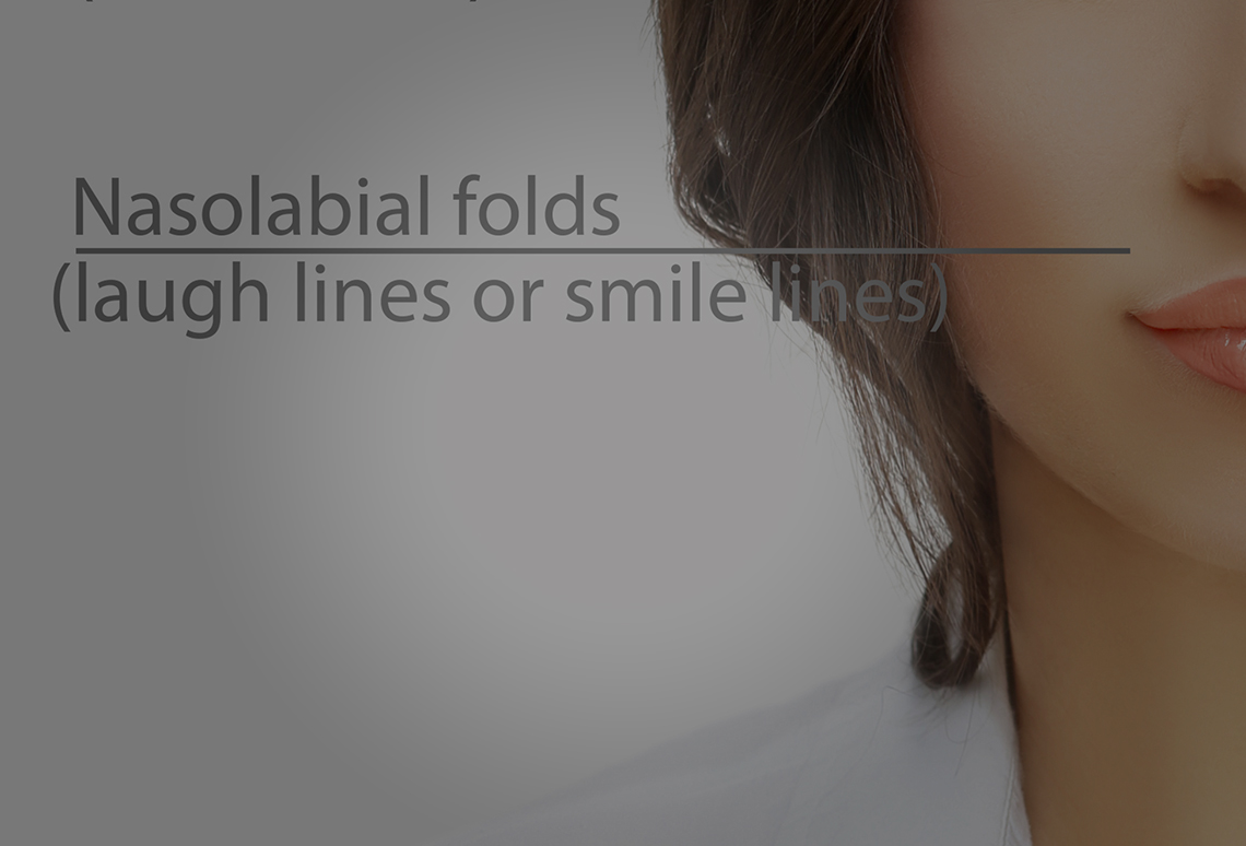 Nasolabial folds - Clinics International